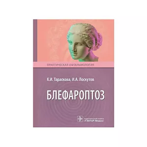Блефароптоз. К. И. Тараскова, И. А. Лоскутов
