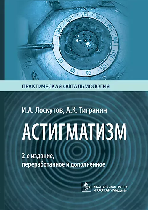 Астигматизм. И. А. Лоскутов, А. К. Тигранян, 2-е изд