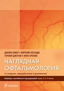 Наглядная офтальмология