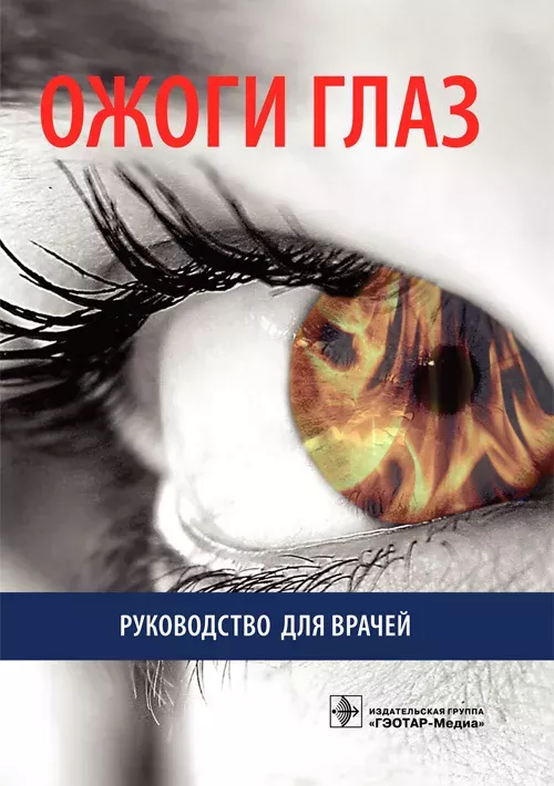 Ожоги глаз. Руководство для врачей