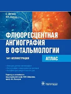 Флюоресцентная ангиография в офтальмологии. Атлас. 2011