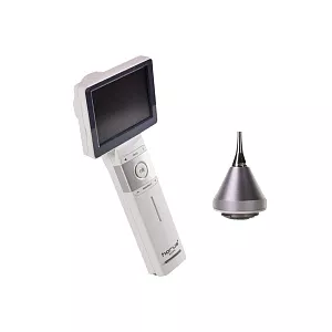 Диагностическая камера MiiS Horus Scope DSC 200P с отоскопом DOC 100S 