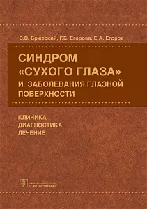 Синдром «сухого глаза» и заболевания глазной поверхности. Клиника, диагностика, лечение